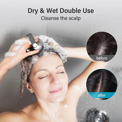 Scalp Massager Brush Handheld Waterproof with 8 Removable Claws - Silver